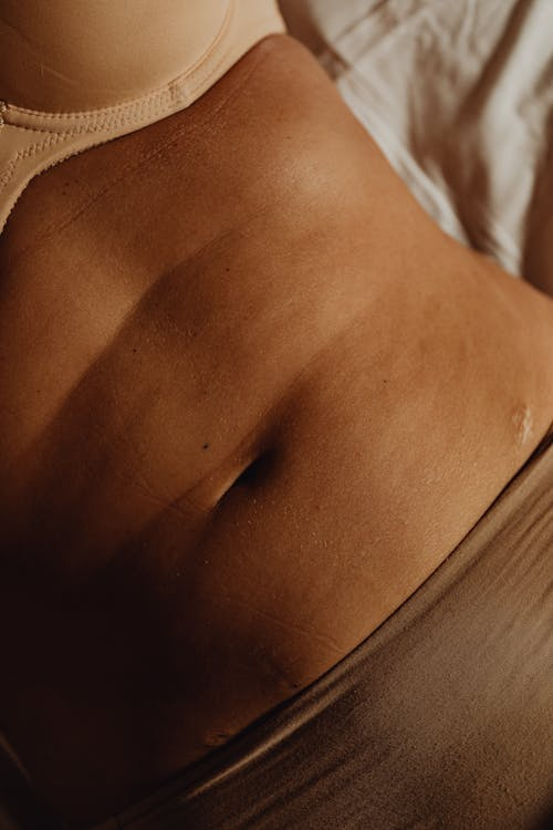Tummy Tuck Lipo and BBL Recovery: 2026 Week-by-Week Guide